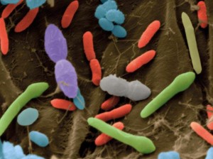 gut-bacteria-300x224