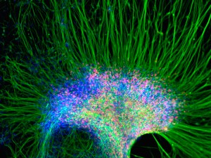 Zhang_neural_stem_cells04